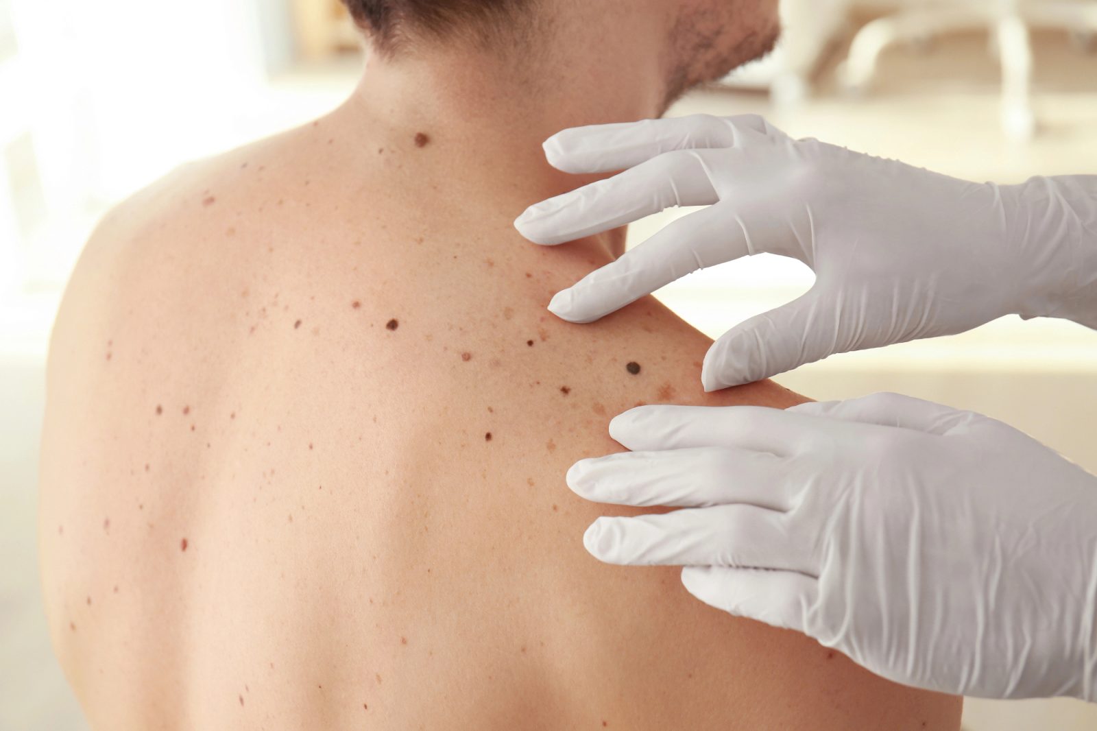 Za zdravje kože je dermatologija zelo pomembna